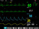 Monitor paciente modular de Oscillometry del parámetro multi E12, exhibición de TFT de 12 pulgadas proveedor