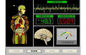Analizador inglés AH-Q9 de resonancia magnética de la salud del cuerpo de Quantum de la versión proveedor