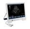 Sistema de diagnóstico del ultrasonido de TS20 Digitaces para el departamento de obstetricia y ginecología proveedor