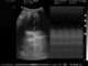 Escáner médico ATNl51353 del ultrasonido de la carretilla de Digitaces de la máquina móvil llena del ultrasonido más 80 elementos proveedor